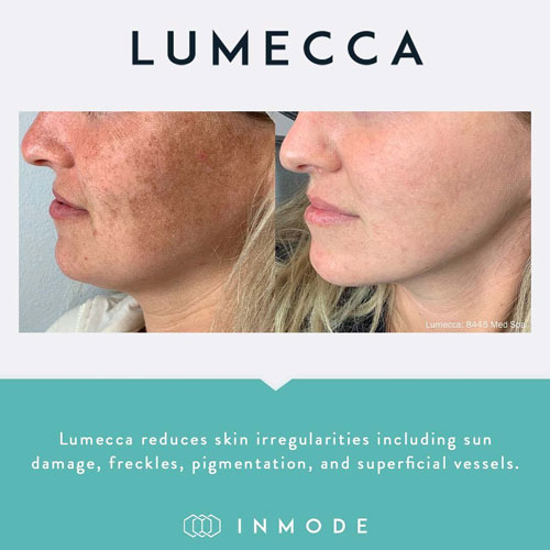 Lumecca Client Pic 1