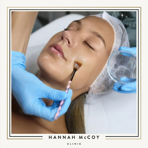 WHAT DO CHEMICAL PEELS DO FOR THE SKIN