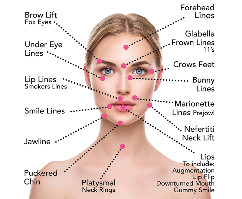 Areas Anti-Wrinkle Treatments Target